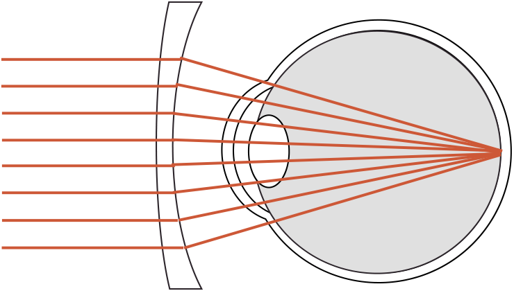A diagram of an aspheric lens showing light rays focusing at a single point and a sharp grid with no edge distortion.