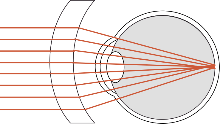 A grid pattern seen through a conventional lens, showing distortion and blur around the edges
